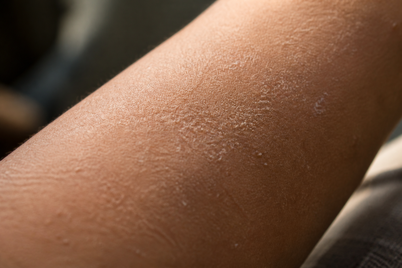 Close-up texture of dry rough bumpy skin on an arm showing visible flakes and uneven texture in soft daylight