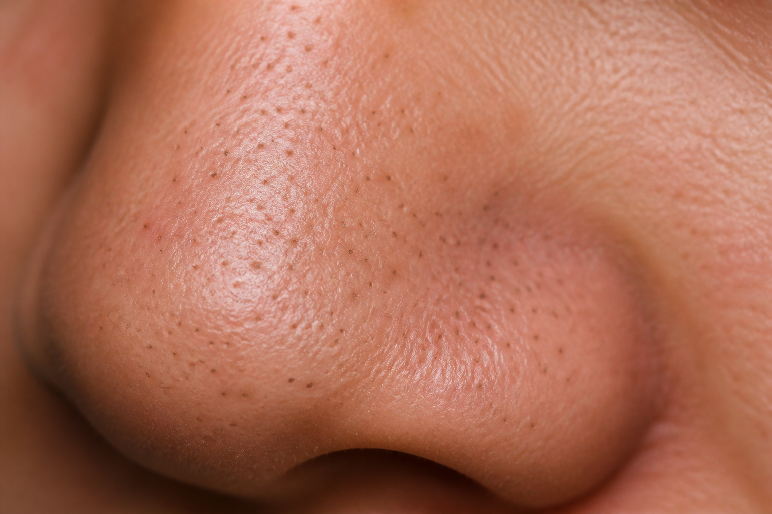 클로즈업 렌즈로 본 검은/blackhead 점들이 있는 코 앞머리 영역, 피부 질감 강조